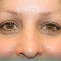 کاشت ابرو تکنیک تار به تار ترکیه با ۱۵ ت|خدمات آرایشگری و زیبایی|تهران, جردن|دیوار