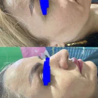جوانسازی لاغری پیرسینگ پاکسازی بوتاکس ژل فیلر