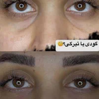 تزریق ژل بوتاکس تاتو پیرسینگ مژه و ...|خدمات آرایشگری و زیبایی|اهواز, پردیس|دیوار