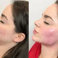 جشنواره پاییزه تزریق ژل بوتاکس مزوژل درکلینیک پزشک|خدمات آرایشگری و زیبایی|اصفهان, وحید|دیوار