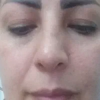 مراقبت پوستی|آرایشی، بهداشتی، درمانی|تهران, شهرک رضویه|دیوار