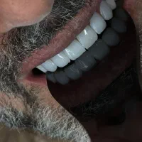 دندانپزشکی اقساط ۱۲ماهه بدون پیش پرداخت|خدمات آرایشگری و زیبایی|تهران, خانی آباد نو شمالی|دیوار
