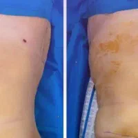 فقط5روزتاپایان جشنواره تخفیفات 50٪ عمل های زیبایی