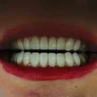 منشی و دستیار مطب دندانپزشکی اندیشه فاز یک