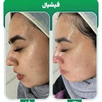 پاکسازی پوست ۲۵۰