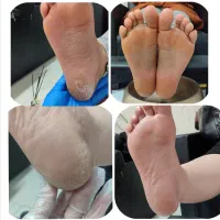 جشنواره پر تخفیف پدیکور|خدمات آرایشگری و زیبایی|مشهد, هفت تیر (آب و برق)|دیوار