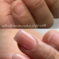 (آموزش تخصصی اصولی ناخن فقط ۳۵۰۰)