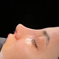 عمل جراحی بینی،لیفت صورت،گوش،اندام|خدمات زیبایی و سلامت|تهران, فلاح|دیوار