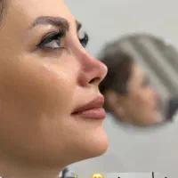 عمل بینی/لیزر co2/پلک/لیپوساکشن/غبغب|خدمات آرایشگری و زیبایی|شیراز, قصرالدشت|دیوار