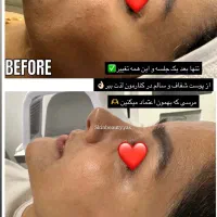 مدل پاکسازی صورت و بدن(خانم و اقا)باهم یا جدا|خدمات آرایشگری و زیبایی|مشهد, کوثر|دیوار