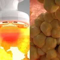 دستگاه لاغری و جوانسازی اراف کویتیشن لیپوزیرو|پزشکی|تهران, ستارخان|دیوار