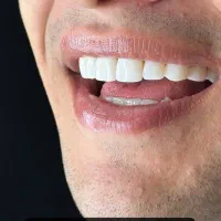 وام ۵۰میلیونی دندانپزشکی