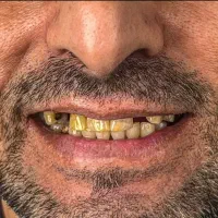 دندانپزشکی مرکز تخصصی ایمپلنت در تبریز|خدمات آرایشگری و زیبایی|مرند, |دیوار