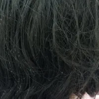 پاکسازی شپش شیوه جدید بدون هزینه مواد و تضمین کتبی