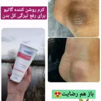 محصول ارایشی و زیبایی|آرایشی، بهداشتی، درمانی|مهاباد (آذربایجان غربی), |دیوار