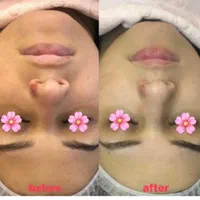 فیشال تخصصی و درمانی قم|خدمات آرایشگری و زیبایی|قم, زنبیل آباد|دیوار