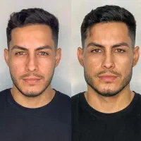 آموزش صفر تا صد زیبایی فیلر و بوتاکس و مزو تراپی|خدمات آرایشگری و زیبایی|اردبیل, |دیوار