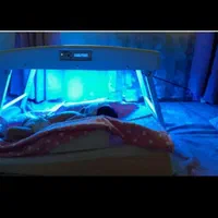 اجاره دستگاه (فتوتراپی) زردی نوزادان
