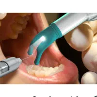 کلینیک دندانپزشکی  تزریق بیحسی بدون درد|آرایشی، بهداشتی، درمانی|کرمان, |دیوار