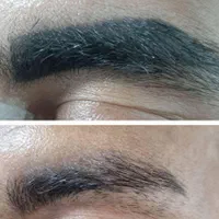 پی ار پی ژل بوتاکس فیلر نخ مزو لیزر ریمو تتو مزوژل|خدمات آرایشگری و زیبایی|مشهد, هفت تیر (حافظ)|دیوار