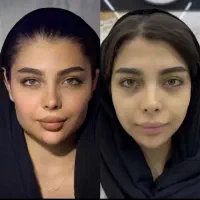 با پول یک پاکسازی، هایفو بزن فقط 890 ت