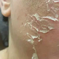 فشیال و پاکسازی پوست وآلگاپیل