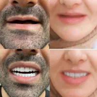 لابراتوار دندانسازی(نیودنت Newdent)|خدمات آرایشگری و زیبایی|کاشمر, |دیوار