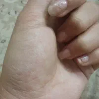 لاک ناخن