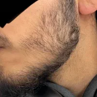 تضمینی ریشاتو دربیاد