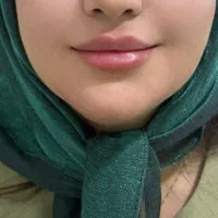 آموزش فیلر و بوتاکس|خدمات آموزشی|کرمان, |دیوار