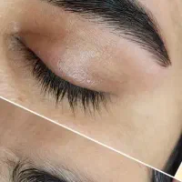 میکروبلیدینگ