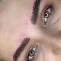 میکروبلیدینگ .فیبروز،شیدینگ لب.بنمژه،