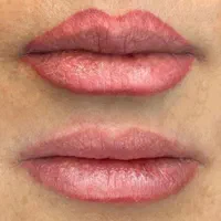 پاک کردن تتوهای قدیمی|خدمات آرایشگری و زیبایی|لنگرود, |دیوار