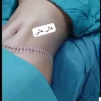 جراحی زیبایی توسط فوق تخصص پلاستیک