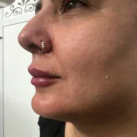 مدل جهت تزریق ژل و بوتاکس و لیفت با نخ|خدمات آرایشگری و زیبایی|ری, شهرری|دیوار