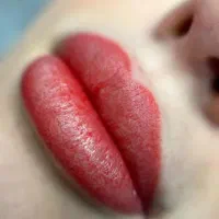 میکروبلیدینگ و شیدینگ لب تخفیف ویژه