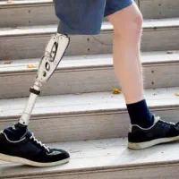 کلینیک تخصصی ساخت پروتز پیشرفته پای مصنوعی|خدمات آرایشگری و زیبایی|فامنین, |دیوار