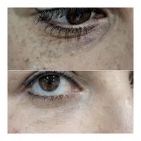 تخفیفات زیبایی و عملهای جراحی