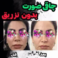 پودرجوانه گندم|خوردنی و آشامیدنی|لاهیجان, کوی آزادگان|دیوار