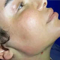 عمل جراحی با فوق متخصص