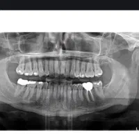 کارشناس رادیولوژی