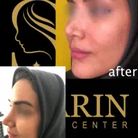 تزریقات زیبایی ژل،بوتاکس،هایفوتراپی،مزوتراپی وفیلر|خدمات آرایشگری و زیبایی|تهران, جنت‌آباد جنوبی|دیوار