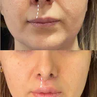 جراحی بینی عمل بینی بلفارو ساکشن غبغب لیفت صورت|خدمات آرایشگری و زیبایی|مشهد, احمدآباد|دیوار