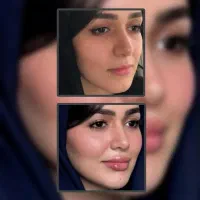 فول فیس کاملا نچرال فقط ۱۱ میلیون
