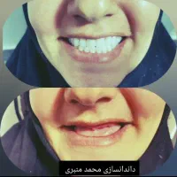 دندانسازی محمد منبری ( سنندج )