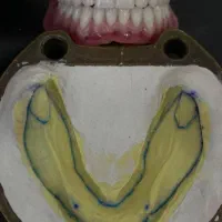 آموزش تخصصی دندانسازی و بلیچینگ و کامپوزیت|خدمات آموزشی|شیراز, معالیآباد|دیوار