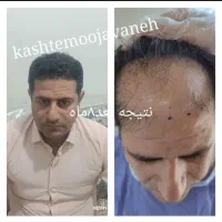 جشنواره یلدایی کاشت موشیرازی از۱۳تومن|خدمات آرایشگری و زیبایی|تهران, صد دستگاه|دیوار