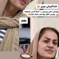 پنکک لاکچری کوین