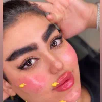 ژل و بوتاکس|خدمات آرایشگری و زیبایی|نسیم‌شهر, |دیوار