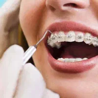 ارتودنسی اقساط بندرعباس ارتودنسی اقساط بندرعباس